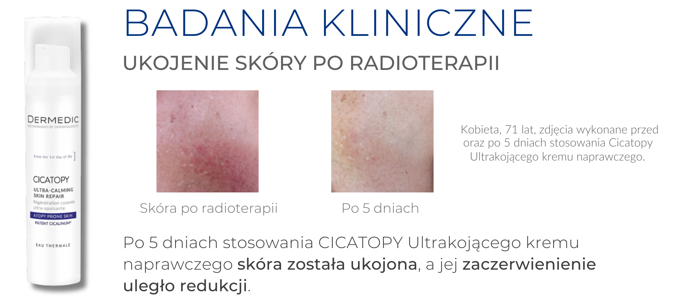 blog długie zdjęcie (35)